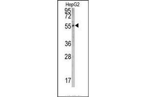 Image no. 1 for anti-Cytochrome P450, Family 2, Subfamily W, Polypeptide 1 (CYP2W1) (N-Term) antibody (ABIN360102) (CYP2W1 抗体  (N-Term))