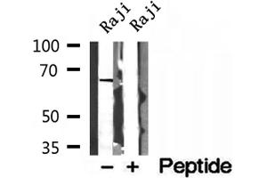 Western blot analysis of extracts of Raji cells, using MTA3 antibody. (MTA3 抗体  (Internal Region))