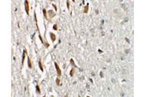 Immunohistochemistry (IHC) image for anti-Teashirt Zinc Finger Homeobox 3 (TSHZ3) (N-Term) antibody (ABIN1031649) (TSHZ3 抗体  (N-Term))