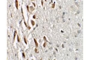 Immunohistochemistry (IHC) image for anti-Zinc Finger Protein 537 (ZNF537) (N-Term) antibody (ABIN1031649) (TSHZ3 抗体  (N-Term))