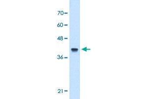 Western Blot analysis of Jurkat cell lysate with IFI44L polyclonal antibody  at 5 ug/mL working concentration. (IFI44L 抗体  (N-Term))