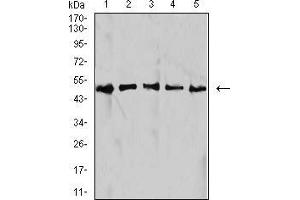 Western Blotting (WB) image for anti-Isocitrate Dehydrogenase 1 (NADP+), Soluble (IDH1) (AA 156-298) antibody (ABIN5542625)