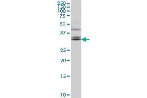 TSPAN32 monoclonal antibody (M02), clone 2B4 Western Blot analysis of TSPAN32 expression in Hela S3 NE . (TSPAN32 抗体  (AA 194-290))