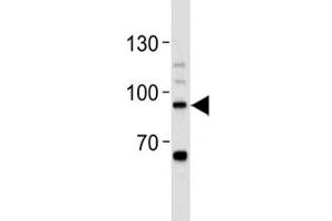 Western Blotting (WB) image for anti-Signal Transducer and Activator of Transcription 3 (Acute-Phase Response Factor) (STAT3) (AA 711-743) antibody (ABIN3032569)