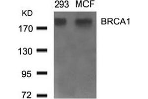 Image no. 2 for anti-Breast Cancer 1 (BRCA1) (Ser1524) antibody (ABIN401620) (BRCA1 抗体  (Ser1524))
