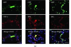 Differentiation of engrafted GFP-labeled ADSCs in the lung of the emphysematous mouse model. (Surfactant Protein C 抗体  (AA 1-193))