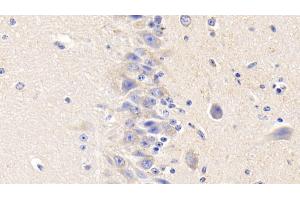 Immunohistochemistry (IHC) image for anti-Coagulation Factor III (thromboplastin, Tissue Factor) (F3) (AA 36-292) antibody (ABIN7442990)