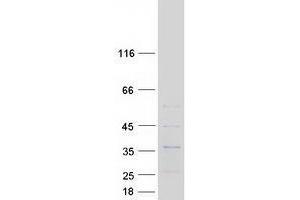 Validation with Western Blot