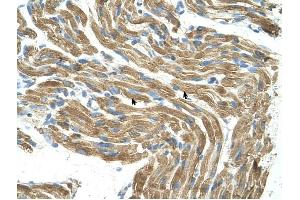 HAL antibody was used for immunohistochemistry at a concentration of 4-8 ug/ml to stain Skeletal muscle cells (arrows) in Human Muscle.