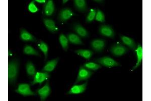 Immunofluorescence analysis of MCF7 cells using TE antibody (ABIN6129489, ABIN6148983, ABIN6148985 and ABIN6222505). (TEAD1 抗体  (AA 135-215))