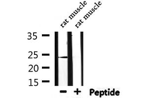Western blot analysis of extracts from rat muscle, using PGF Antibody. (PLGF 抗体  (Internal Region))
