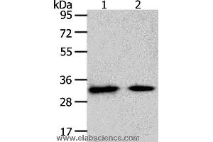 Western blot analysis of Mouse heart and muscle tissue, using SLC25A4 Polyclonal Antibody at dilution of 1:400 (SLC25A4 抗体)