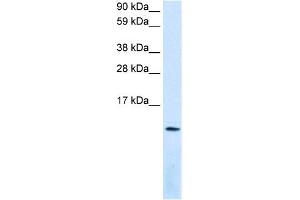 WB Suggested Anti-CXCL12 Antibody Titration:  0. (CXCL12 抗体  (Middle Region))
