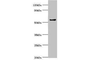 Western blot All lanes: Cytochrome P450 3A5 antibody at 9 μg/mL + Mouse liver tissue Secondary Goat polyclonal to rabbit IgG at 1/10000 dilution Predicted band size: 58, 16 kDa Observed band size: 58 kDa (CYP3A5 抗体  (AA 233-502))