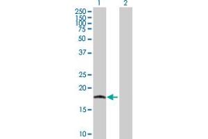 Western Blot analysis of IL17C expression in transfected 293T cell line by IL17C MaxPab polyclonal antibody. (IL17C 抗体  (AA 1-197))