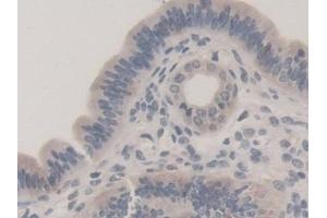 Detection of TUBb1 in Mouse Uterus Tissue using Polyclonal Antibody to Tubulin Beta 1 (TUBb1) (TUBB1 抗体  (AA 182-437))