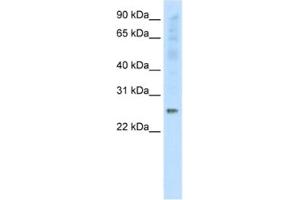 Western Blotting (WB) image for anti-Synaptosomal-Associated Protein, 25kDa (SNAP25) antibody (ABIN2463769) (SNAP25 抗体)