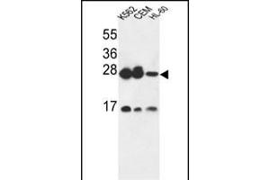 ANP32A Antibody (C-term) (ABIN6243481 and ABIN6579058) western blot analysis in K562,CEM,HL-60 cell line lysates (35 μg/lane). (PHAP1 抗体  (C-Term))