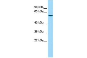 Host: Rabbit Target Name: MMP27 Sample Type: Fetal Lung lysates Antibody Dilution: 1. (MMP27 抗体  (Middle Region))