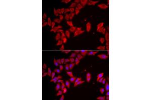 Immunofluorescence analysis of HeLa cells using SLC35 antibody (ABIN6133144, ABIN6147991, ABIN6147992 and ABIN6223068). (SLC35A2 抗体  (AA 1-242))