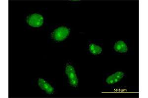 Immunofluorescence of monoclonal antibody to CYLD on HeLa cell. (CYLD 抗体  (AA 854-953))