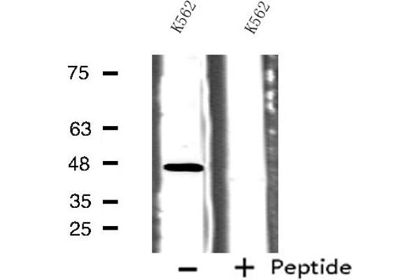 5HT1B Receptor 抗体  (Internal Region)