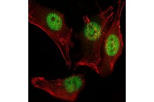 Immunofluorescent analysis of 4 % paraformaldehyde-fixed, 0. (MYOD1 抗体  (AA 211-240))