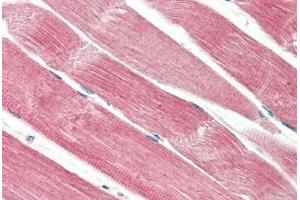 Human Skeletal Muscle: Formalin-Fixed, Paraffin-Embedded (FFPE) (THNSL2 抗体  (AA 82-94))