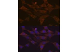 Immunofluorescence analysis of NIH-3T3 cells using PKC delta Rabbit mAb  at dilution of 1:100 (40x lens). (PKC delta 抗体)