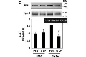 Western Blot of Anti-Apolipoprotein J Antibody. (Clusterin 抗体)