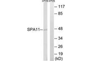 Western blot analysis of extracts from HT-29 cells, using SERPINA11 Antibody. (SERPINA11 抗体  (AA 191-240))