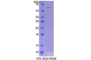 SDS-PAGE analysis of Rat COQ6 Protein. (COQ6 蛋白)
