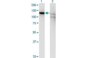 Western Blot analysis of SLC4A1AP expression in transfected 293T cell line by SLC4A1AP monoclonal antibody (M01), clone 2G10. (NADAP 抗体  (AA 154-254))