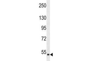 Western blot analysis of ZAK antibody and HepG2 lysate. (ZAK 抗体  (AA 271-300))