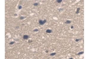 Detection of PNPO in Mouse Cerebrum Tissue using Polyclonal Antibody to Pyridoxamine-5'-Phosphate Oxidase (PNPO) (PNPO 抗体  (AA 1-261))
