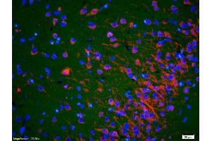 Formalin-fixed and paraffin-embedded rat brain labeled with Anti-ACTH (18-39) Polyclonal Antibody, Unconjugated (ABIN668661) 1:200, overnight at 4°C, The secondary antibody was Goat Anti-Rabbit IgG, Cy3 conjugated used at 1:200 dilution for 40 minutes at 37°C. (ACTH 抗体  (AA 18-39))