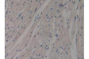 IHC-P analysis of Mouse Heart Tissue, with DAB staining. (MUC1 抗体  (AA 474-630))