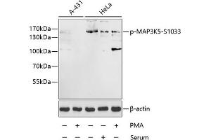 Western blot analysis of extracts of A-431 and HeLa cells, using Phospho-MK5-S1033 antibody (ABIN3019484, ABIN3019485, ABIN3019486 and ABIN6225423) at 1:1000 dilution. (ASK1 抗体  (pSer1033))