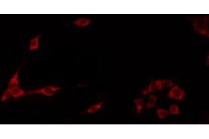ABIN6272249 staining Hela by IF/ICC. (ARRDC1 抗体  (C-Term))