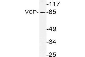 Western blot (WB) analysis of VCP antibody in extracts from 3T3 cells. (VCP 抗体)