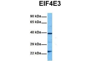 Host:  Rabbit  Target Name:  EIF4E3  Sample Tissue:  Human DLD1  Antibody Dilution:  1. (EIF4E3 抗体  (Middle Region))