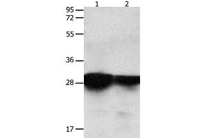 Western Blot analysis of Human brain malignant glioma and laryngocarcinoma tissue using 14-3-3 epsilon Polyclonal Antibody at dilution of 1:2200 (YWHAE 抗体)