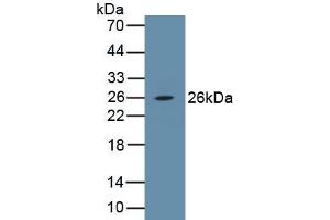 Detection of Recombinant PDGFB, Porcine using Polyclonal Antibody to Platelet Derived Growth Factor Subunit B (PDGFB) (PDGFB 抗体  (AA 84-199))