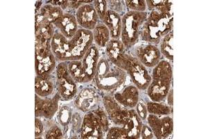 Immunohistochemical staining of human kidney with TRMT61B polyclonal antibody  shows strong cytoplasmic positivity in tubular cells. (TRMT61B 抗体)