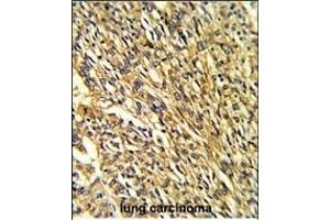 Immunohistochemistry (Paraffin-embedded Sections) (IHC (p)) image for anti-Potassium Inwardly-Rectifying Channel, Subfamily J, Member 2 (KCNJ2) (AA 401-427), (C-Term) antibody (ABIN390913)