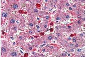 Human Liver: Formalin-Fixed, Paraffin-Embedded (FFPE) (CBS 抗体  (AA 1-101))
