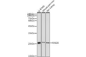 Western blot analysis of extracts of various cell lines, using R antibody (ABIN7269802) at 1:1000 dilution. (RAB26 抗体  (AA 1-60))
