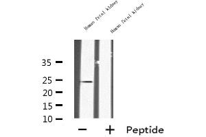 Western blot analysis of INSL6 expression in Human fetal kidney lysate,The lane on the left is treated with the antigen-specific peptide. (INSL6 抗体  (Internal Region))