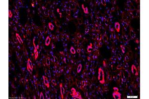 Formalin-fixed and paraffin-embedded human kidney labeled with Anti-CD54/ICAM-1 Polyclonal Antibody, Unconjugated (ABIN707651) 1:200, overnight at 4°C, The secondary antibody was Goat Anti-Rabbit IgG, Cy3 conjugated used at 1:200 dilution for 40 minutes at 37°C. (ICAM1 抗体  (AA 51-100))