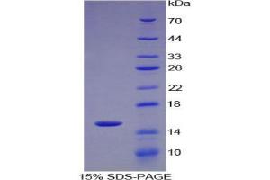 SDS-PAGE analysis of Human alpha Fodrin Protein. (SPTAN1 蛋白)